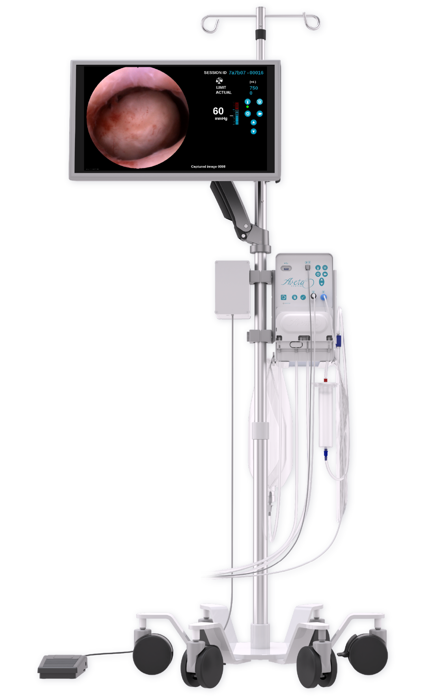 Aveta System Horizon Medical